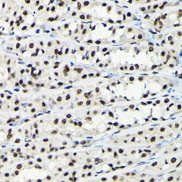 Anti-EFTUD2 antibody used in IHC (Paraffin sections) (IHC-P). GTX55602