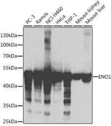 Anti-ENO1 antibody used in Western Blot (WB). GTX55604