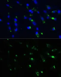 Anti-ENO1 antibody used in Immunocytochemistry/ Immunofluorescence (ICC/IF). GTX55604