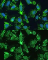 Anti-ENO1 antibody used in Immunocytochemistry/ Immunofluorescence (ICC/IF). GTX55604