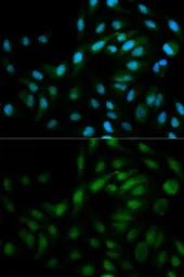 Anti-ERK5 antibody used in Immunocytochemistry/ Immunofluorescence (ICC/IF). GTX55608