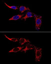 Anti-FIS1 antibody used in Immunocytochemistry/ Immunofluorescence (ICC/IF). GTX55624