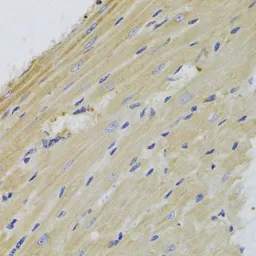 Anti-FIS1 antibody used in IHC (Paraffin sections) (IHC-P). GTX55624