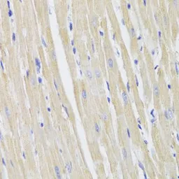 Anti-FIS1 antibody used in IHC (Paraffin sections) (IHC-P). GTX55624