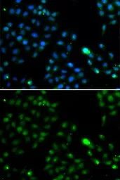 Anti-FKBP25 antibody used in Immunocytochemistry/ Immunofluorescence (ICC/IF). GTX55625