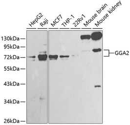 Anti-GGA2 antibody used in Western Blot (WB). GTX55637