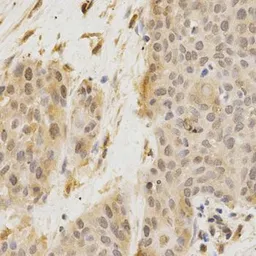 Anti-GGA2 antibody used in IHC (Paraffin sections) (IHC-P). GTX55637