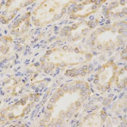 Anti-GGA2 antibody used in IHC (Paraffin sections) (IHC-P). GTX55637