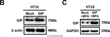 Anti-GIP antibody used in Western Blot (WB). GTX55639