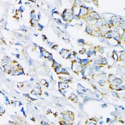 Anti-Hexokinase II antibody used in IHC (Paraffin sections) (IHC-P). GTX55657