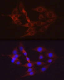 Anti-Hexokinase II antibody used in Immunocytochemistry/ Immunofluorescence (ICC/IF). GTX55657