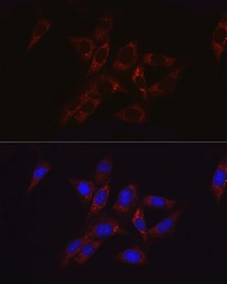 Anti-Hexokinase II antibody used in Immunocytochemistry/ Immunofluorescence (ICC/IF). GTX55657