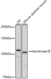 Anti-Hexokinase II antibody used in Western Blot (WB). GTX55657