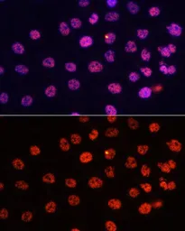 Anti-Histone H3K4me2 (di-methyl Lys4) antibody used in Immunocytochemistry/ Immunofluorescence (ICC/IF). GTX55660