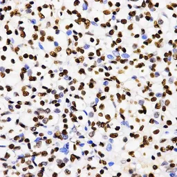 Anti-Histone H3K4me2 (di-methyl Lys4) antibody used in IHC (Paraffin sections) (IHC-P). GTX55660