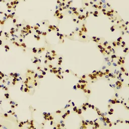 Anti-Histone H3K4me2 (di-methyl Lys4) antibody used in IHC (Paraffin sections) (IHC-P). GTX55660