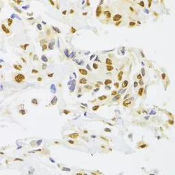 Anti-hnRNP A1 antibody used in IHC (Paraffin sections) (IHC-P). GTX55663