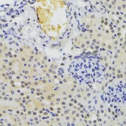 Anti-hnRNP A1 antibody used in IHC (Paraffin sections) (IHC-P). GTX55663