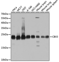 Anti-HP1 gamma antibody used in Western Blot (WB). GTX55664