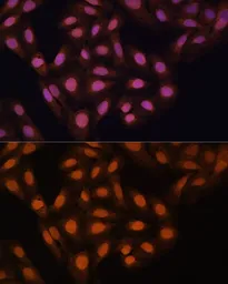Anti-HP1 gamma antibody used in Immunocytochemistry/ Immunofluorescence (ICC/IF). GTX55664