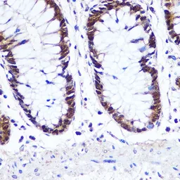 Anti-IRF1 antibody used in IHC (Paraffin sections) (IHC-P). GTX55681