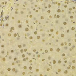 Anti-Jab1 antibody used in IHC (Paraffin sections) (IHC-P). GTX55683