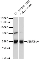 Anti-Kallistatin antibody used in Western Blot (WB). GTX55684