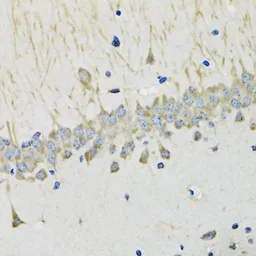 Anti-Kallistatin antibody used in IHC (Paraffin sections) (IHC-P). GTX55684