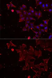 Anti-MSRA antibody used in Immunocytochemistry/ Immunofluorescence (ICC/IF). GTX55713