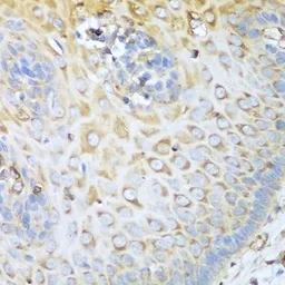 Anti-MYH9 antibody used in IHC (Paraffin sections) (IHC-P). GTX55718