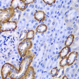 Anti-Myosin 1C antibody used in IHC (Paraffin sections) (IHC-P). GTX55719