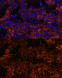 Anti-PAI-1 antibody used in IHC (Paraffin sections) (IHC-P). GTX55737