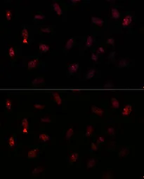 Anti-PAX6 antibody used in Immunocytochemistry/ Immunofluorescence (ICC/IF). GTX55739