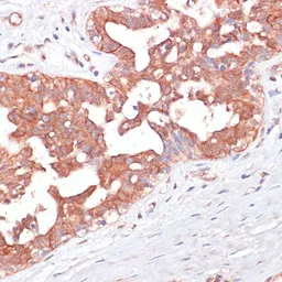 Anti-PGD antibody used in IHC (Paraffin sections) (IHC-P). GTX55744