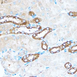 Anti-PI3 kinase p110 alpha antibody used in IHC (Paraffin sections) (IHC-P). GTX55747