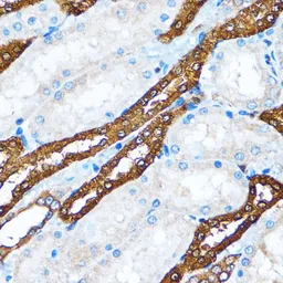 Anti-PI3 kinase p110 alpha antibody used in IHC (Paraffin sections) (IHC-P). GTX55747