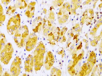 Anti-PKC epsilon antibody used in IHC (Paraffin sections) (IHC-P). GTX55749