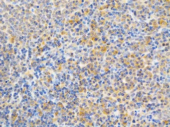 Anti-PKC epsilon antibody used in IHC (Paraffin sections) (IHC-P). GTX55749