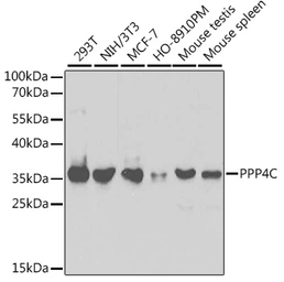 Anti-PPP4C antibody used in Western Blot (WB). GTX55756