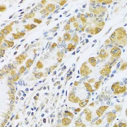 Anti-PSG1 antibody used in IHC (Paraffin sections) (IHC-P). GTX55761