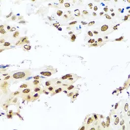 Anti-RAB3IP antibody used in IHC (Paraffin sections) (IHC-P). GTX55771