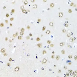 Anti-RAB3IP antibody used in IHC (Paraffin sections) (IHC-P). GTX55771