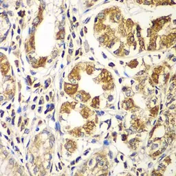 Anti-Rac1 antibody used in IHC (Paraffin sections) (IHC-P). GTX55772