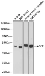 Anti-RAGE antibody used in Western Blot (WB). GTX55773