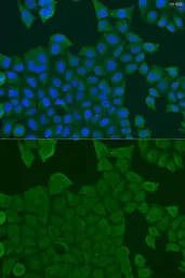 Anti-REEP1 antibody used in Immunocytochemistry/ Immunofluorescence (ICC/IF). GTX55777