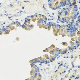 Anti-REG III alpha antibody used in IHC (Paraffin sections) (IHC-P). GTX55778