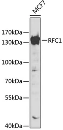 Anti-RFC1 antibody used in Western Blot (WB). GTX55779