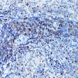 Anti-SATB1 antibody used in IHC (Paraffin sections) (IHC-P). GTX55787