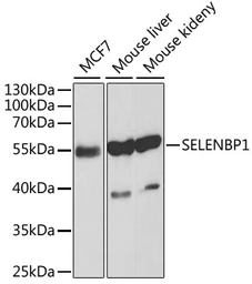 Anti-SELENBP1 antibody used in Western Blot (WB). GTX55788