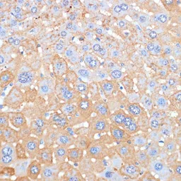 Anti-Serum Amyloid P antibody used in IHC (Paraffin sections) (IHC-P). GTX55792